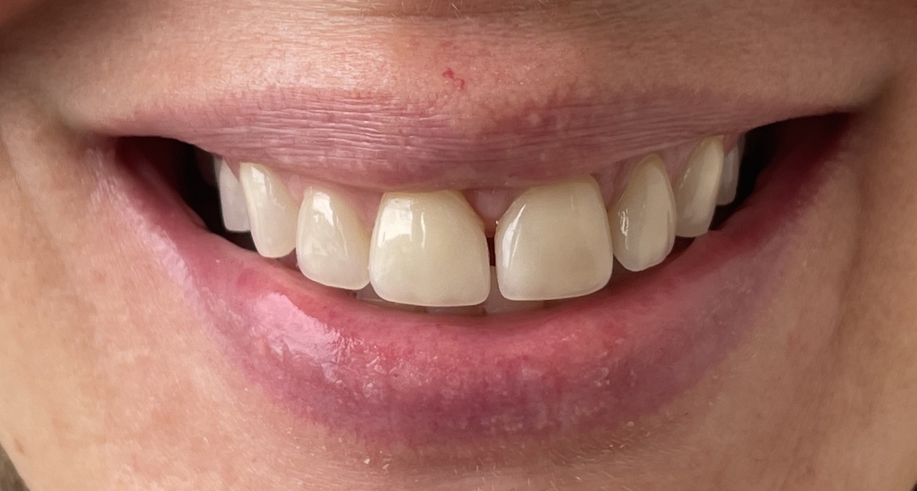 Close-up smile