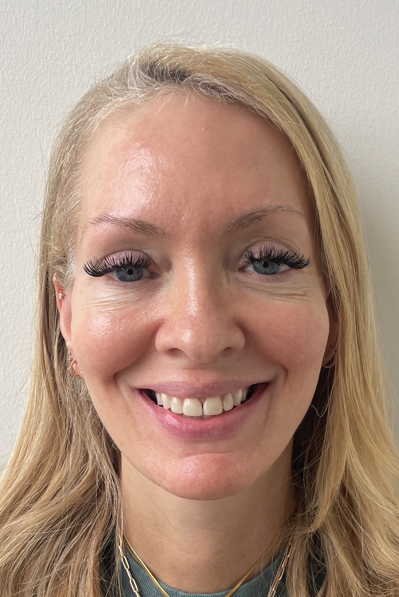 Patient facial photo